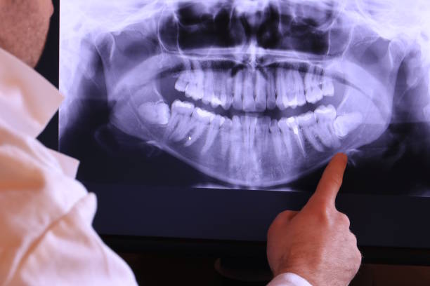 Best Emergency Dental Care for Broken or Chipped Teeth in League City, TX