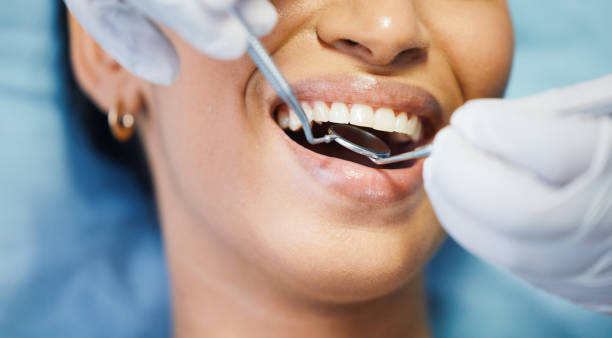 Best Emergency Orthodontic Services in League City, TX